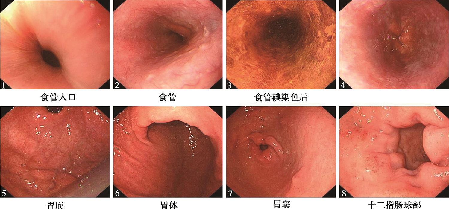 图4 食管镜、胃镜检查